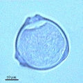 Microphotographie de pollens de Bouleau