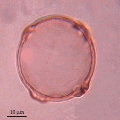 Microphotographie d'un grain de pollen de Charme