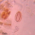 Microphotographie d'un grain de pollen de Chataignier
