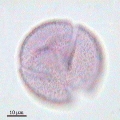 Microphotographie de pollens de Chêne