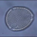 Microphotographie de pollens de Fresne