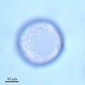 Microphotographie de pollens de Peuplier