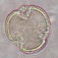 Microphotographie d'un grain de pollen de Platane